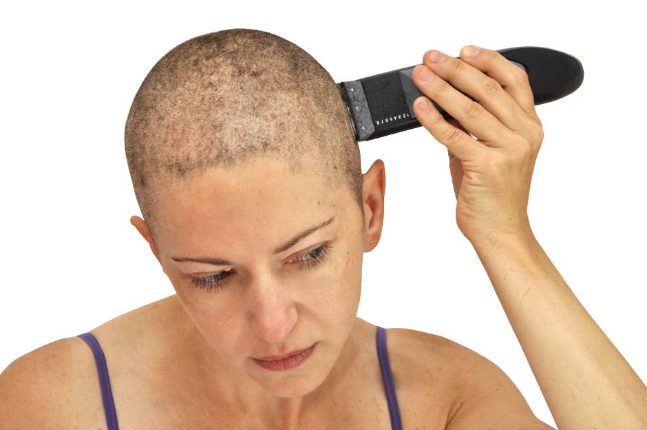 No recibir quimioterapia por miedo a la alopecia