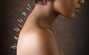 Aprendamos más sobre la acupuntura